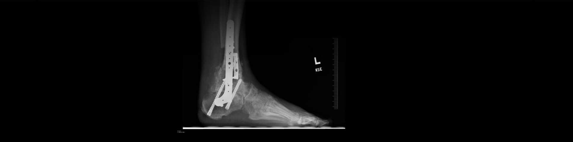 Personal Injury - High Point, NC - Schoch & Schoch Personal Injury - High Point, NC - Schoch & Schoch