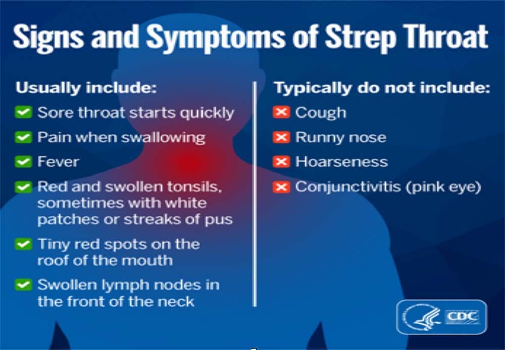 CDC infographic on strep throat signs and symptoms, listing common and uncommon symptoms in blue panels