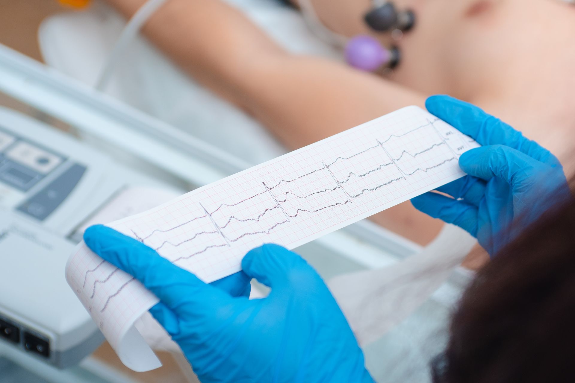 Gloved hands holding a printed ECG strip beside a hospital monitor