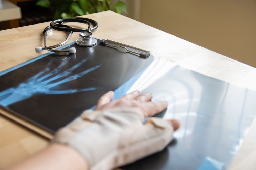 Hand holding a chest X-ray film beside a stethoscope on a table