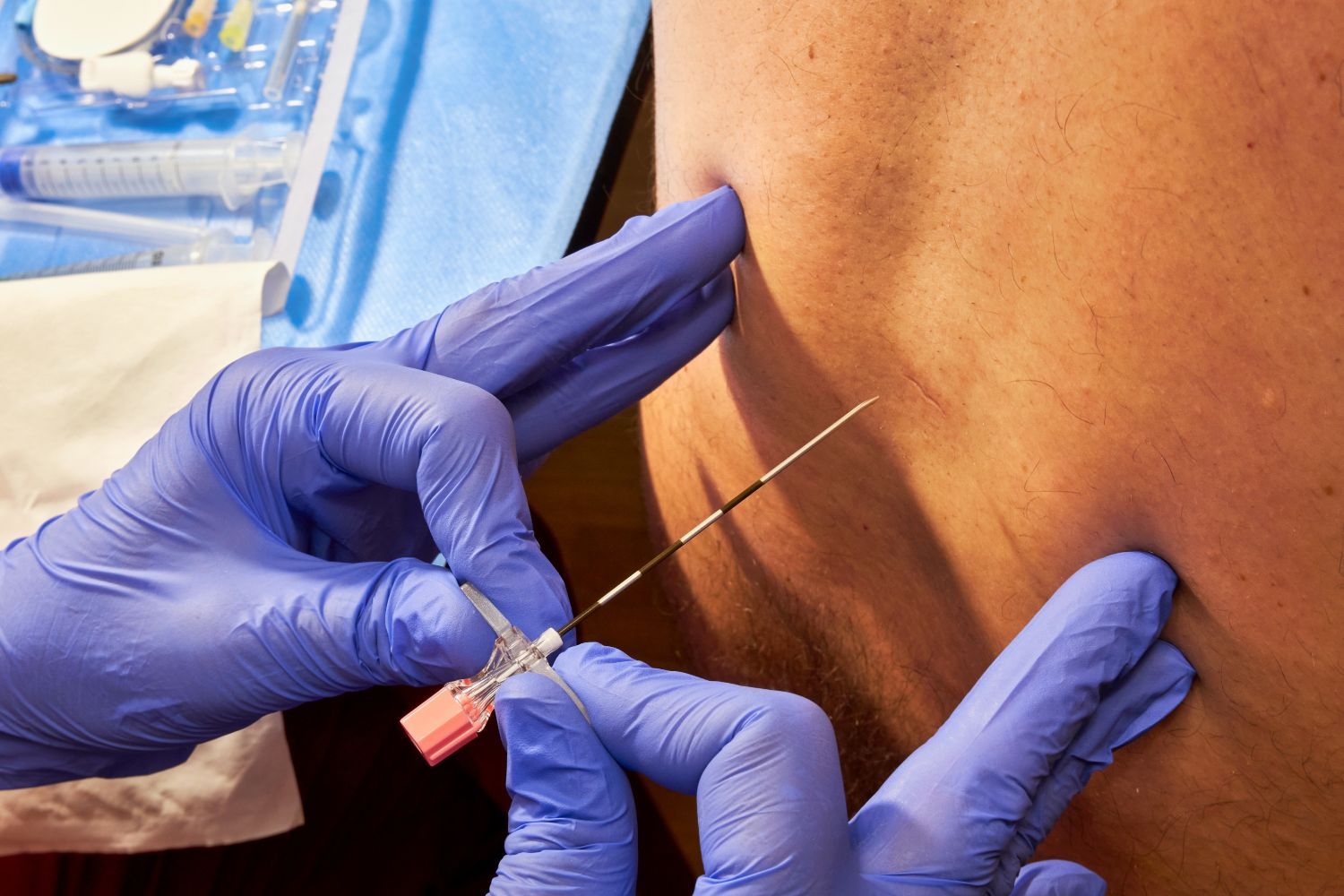 back injection