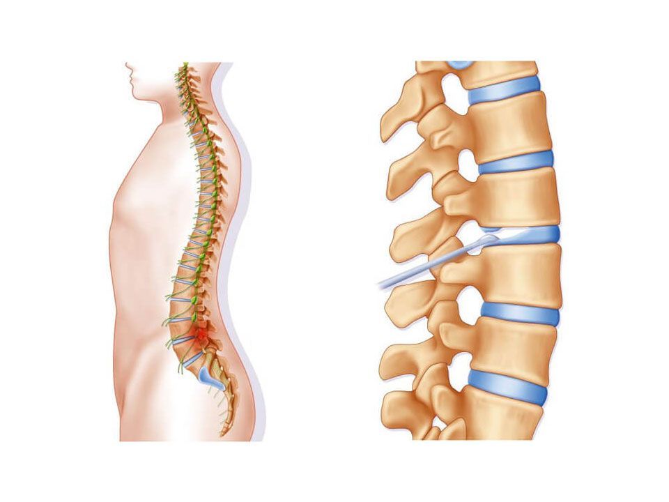 spinal cord