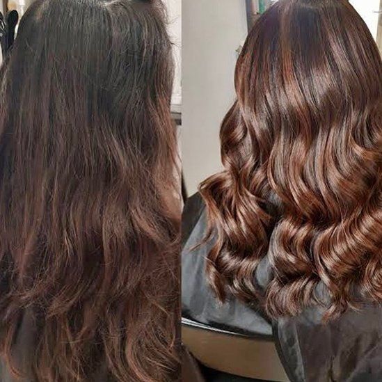 Hair Restoration Treatment — Eastern Creek NSW — Hair & Co