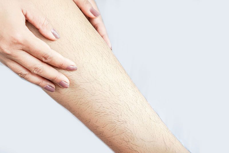 Hair Removal