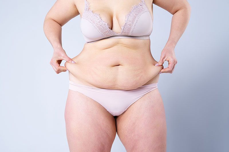 Sagging Skin, Volume Loss