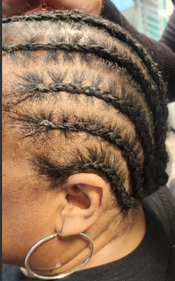 Close-up of a person's head showing cornrow braids in the hair.