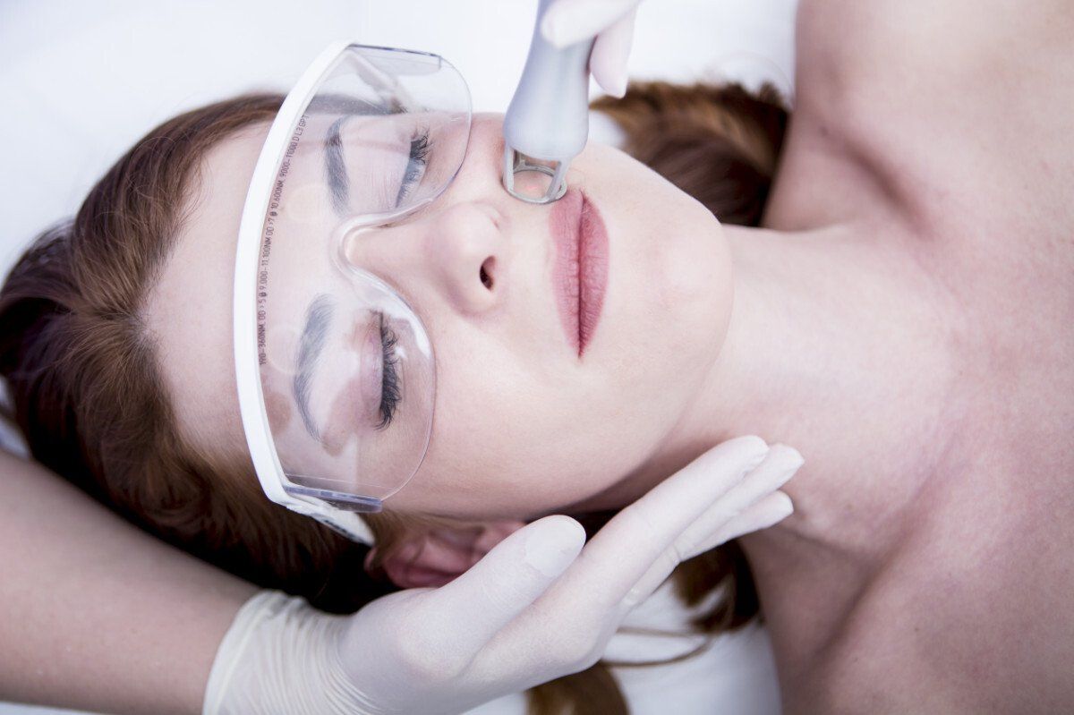 trattamento viso con laser