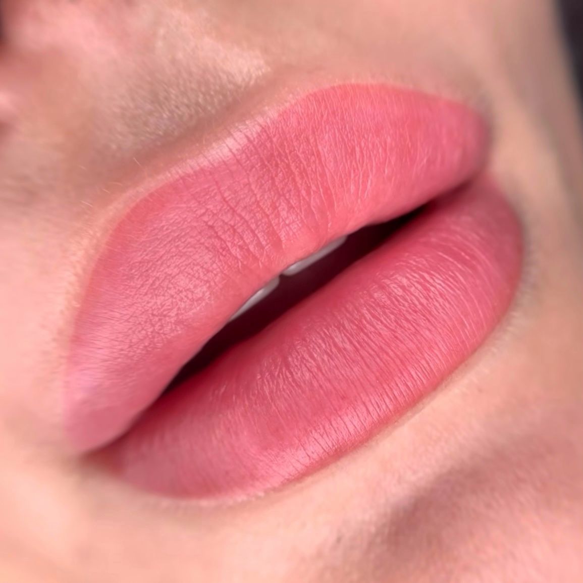 Nahaufnahme von vollen, rosafarbenen Lippen mit einem natürlich wirkenden Lippen-Rouge, einem kosmetischen Eingriff.