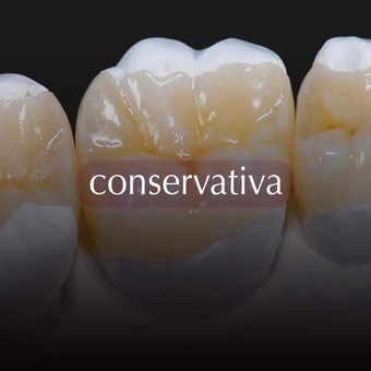 Odontoiatria Conservativa conservativa