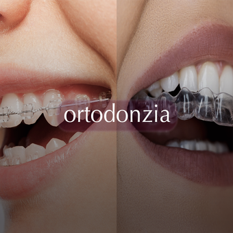 Apparecchio Dentale - Ortodonzia ortodonzia
