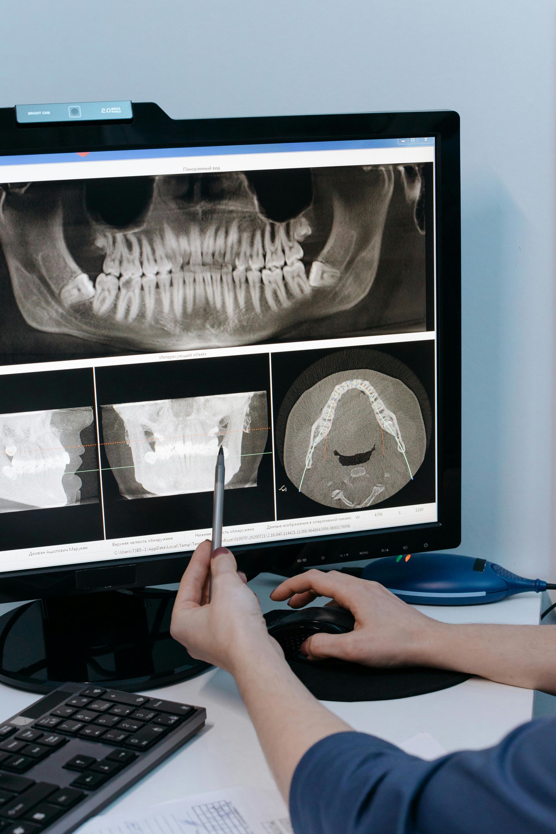 cancer screenings