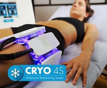 Eine Frau liegt auf einem Bett und bekommt eine Kryo-4s-Behandlung