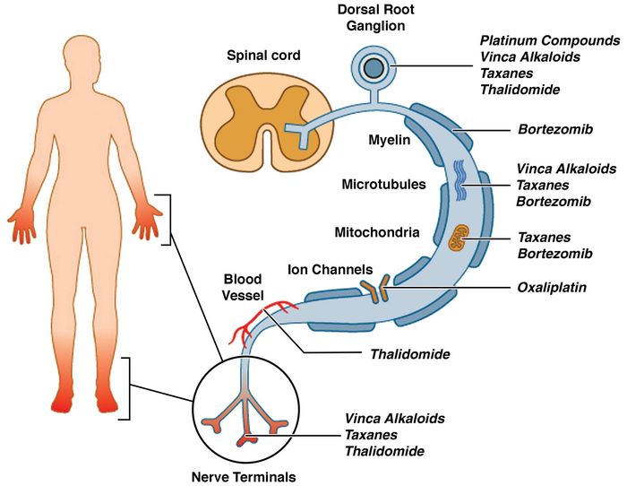 Diagram of nerve pathway drugs blocking ion channels, microtubules, and blood vessels in a leg nerve.