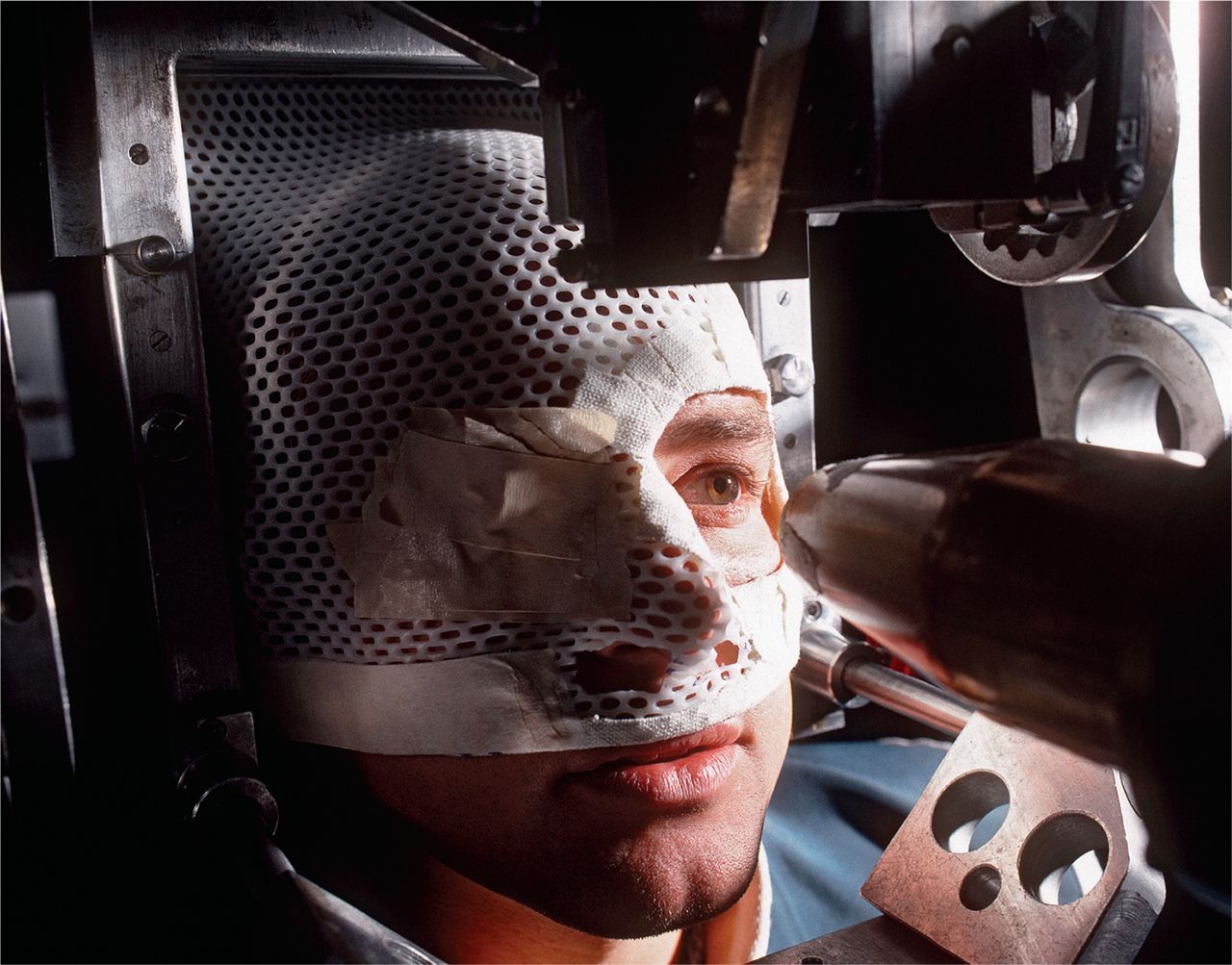 Radiation therapy for head and neck cancer is rarely guided by analyzing DNA.