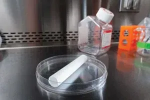 A cigar-shaped plastic tube was seeded with bone marrow cells to create an engineered blood vessel.