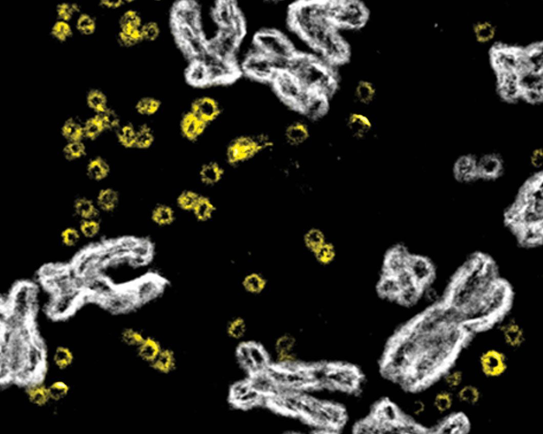 Yellow rings of DNA amidst white chromosomes