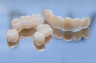Dental crowns and bridges, white porcelain, reflected on a blue surface.