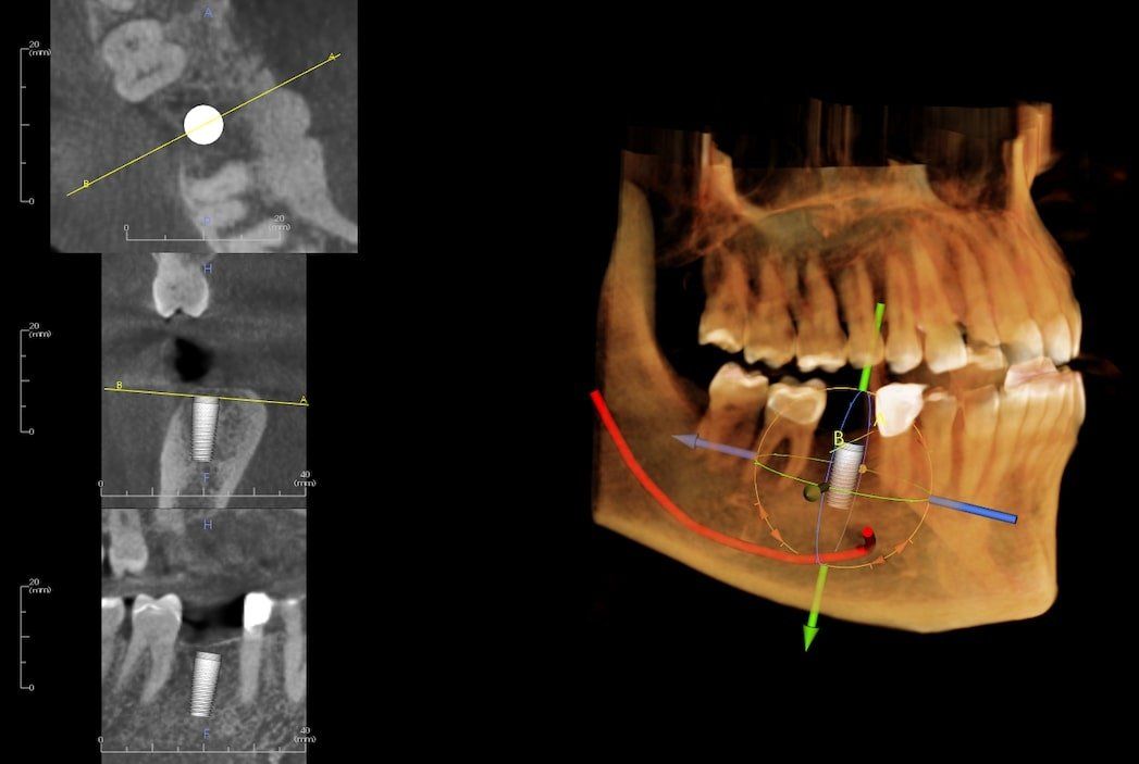 A computer generated image of a skull and teeth.