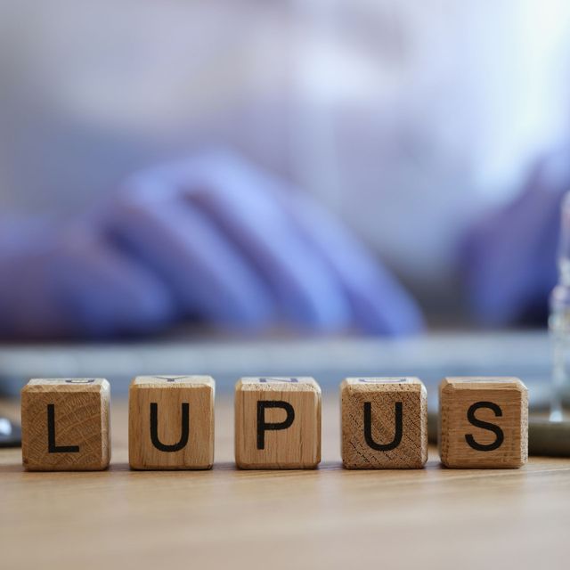 Lupus Treatments PRP, Stem Cells, and Peptide Therapy in Newport Beach, CA