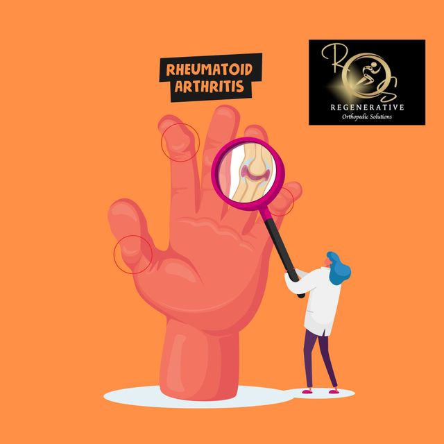 Rheumatoid Arthritis in Newport Beach, California