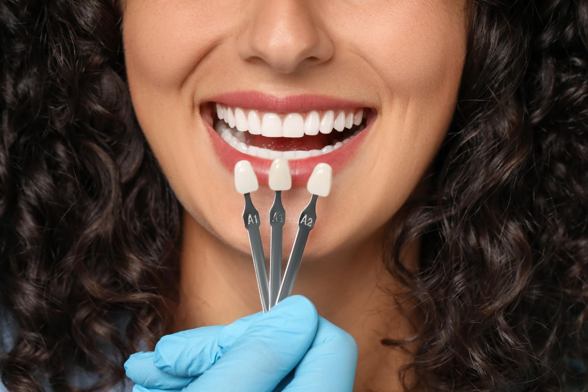 A person holds a shade guide with three tooth-colored tabs up to a patient's smile to color-match dental veneers.