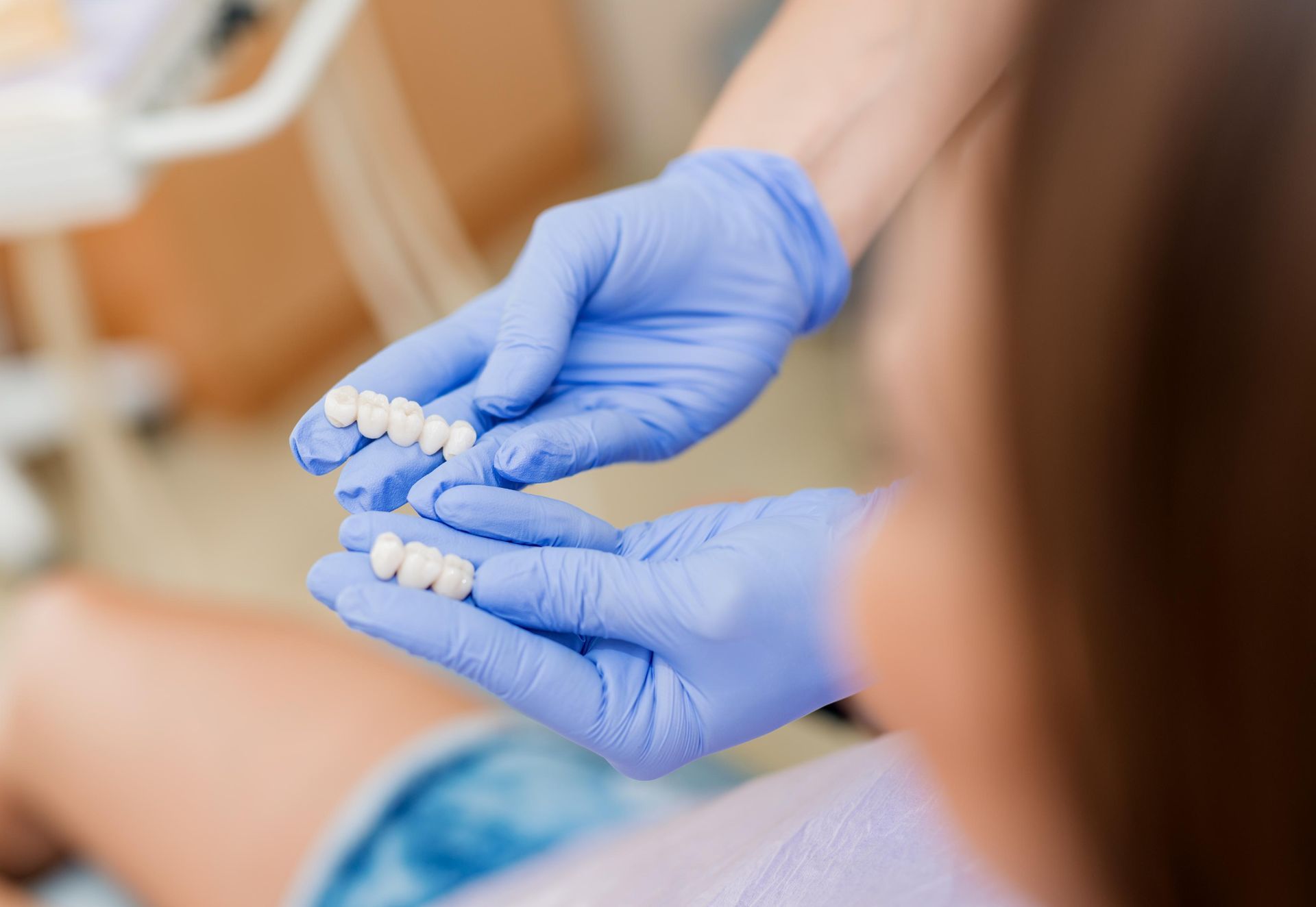 A dental professional wearing blue nitrile gloves holds two dental bridge restorations in a clinical setting.
