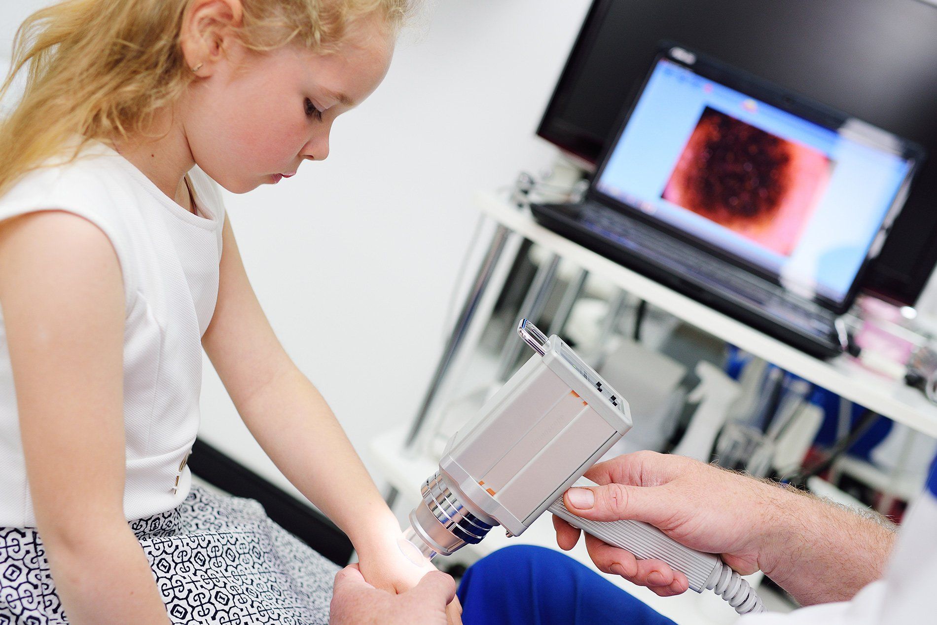 Videodermatoscopia