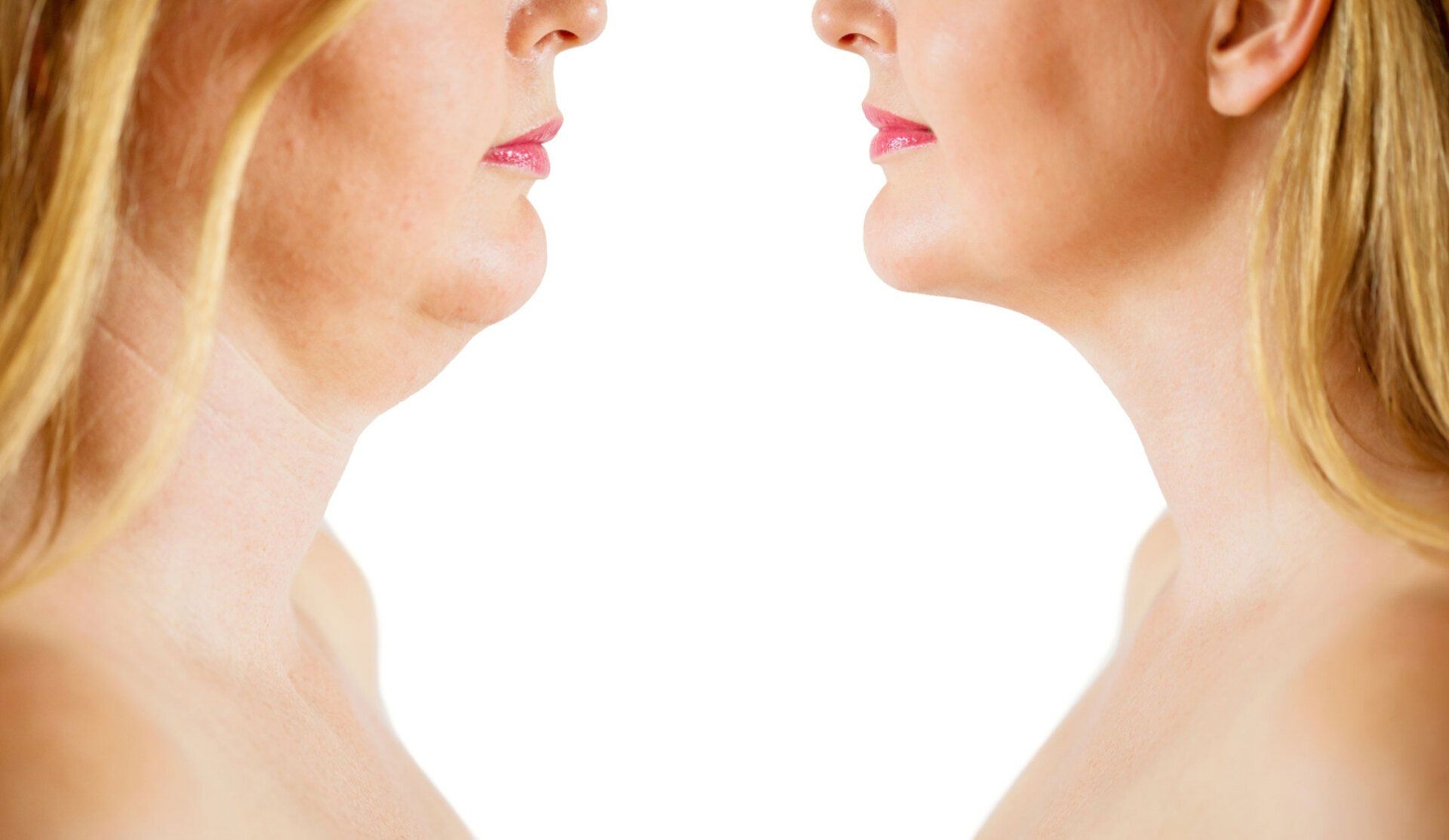 Fat Dissolving Injections — Sydney, NSW — Lulu Cosmetics
