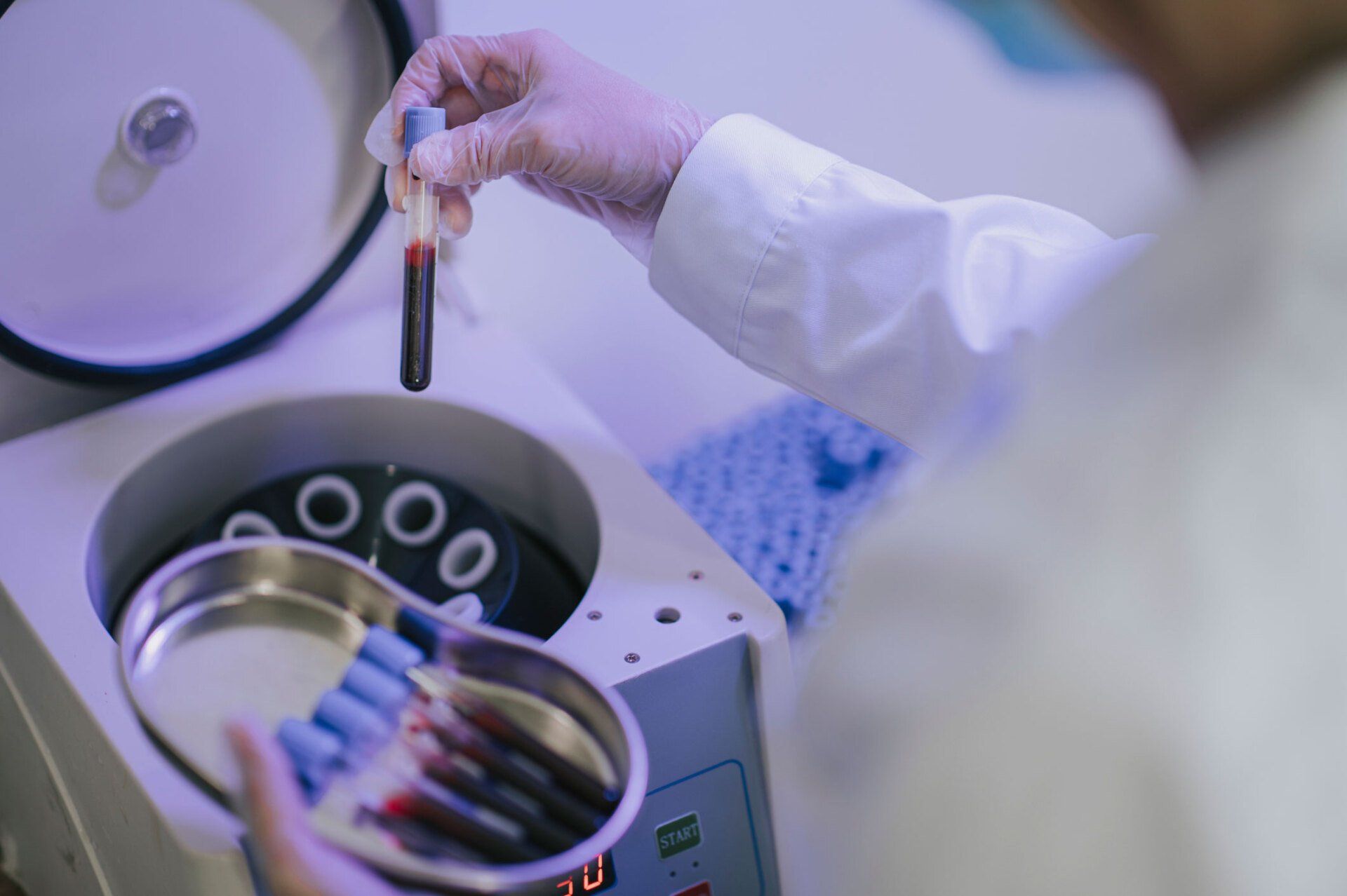 Therapy Using Centrifuge Machine — Sydney, NSW — Lulu Cosmetics