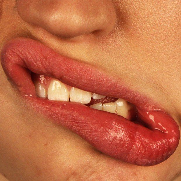 Bleeding Gums: Causes and Treatment | Spring Hill Dental Center