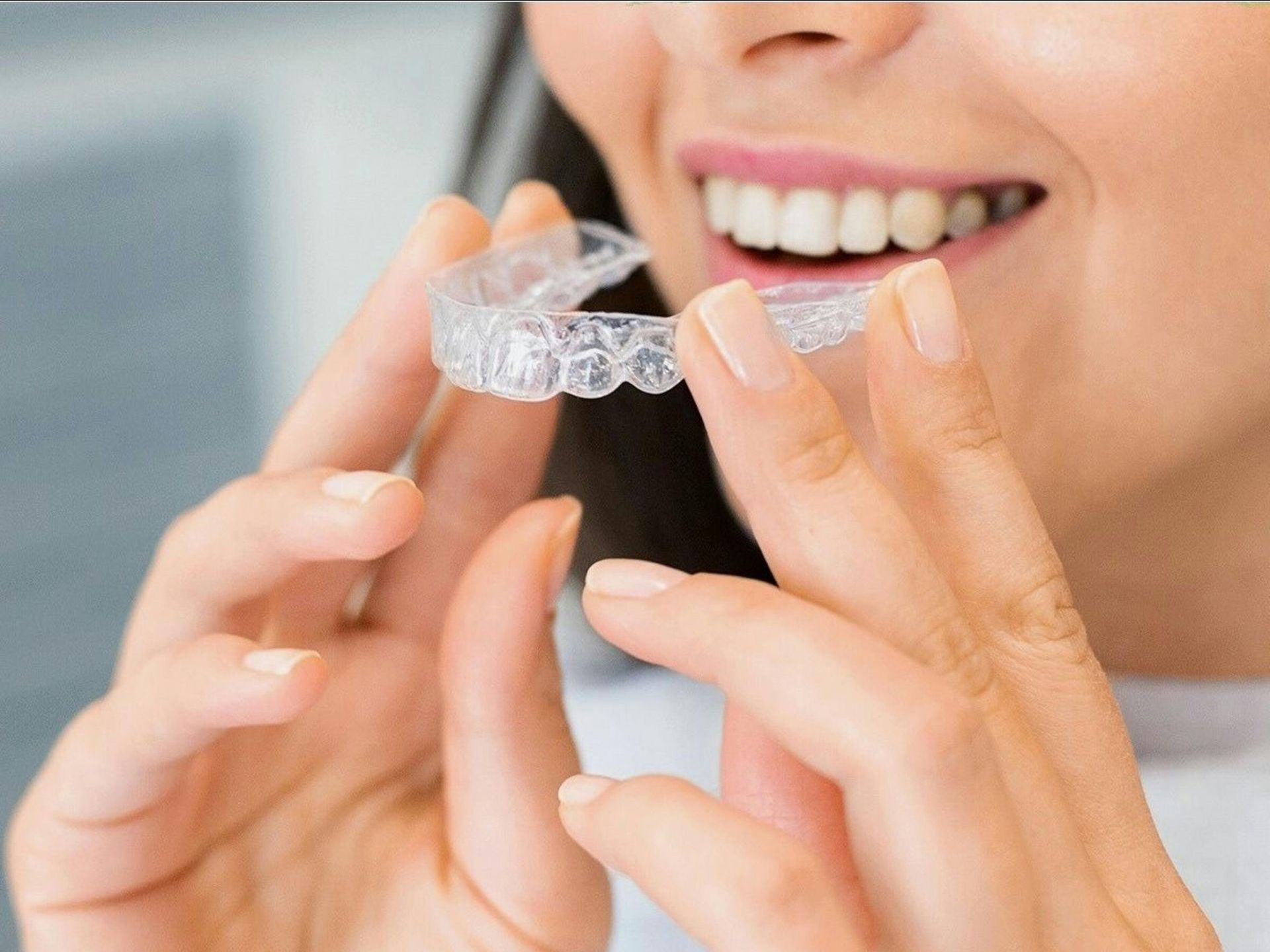 What Are Clear Aligners and How Do They Work? | Spring Hill Dental Center