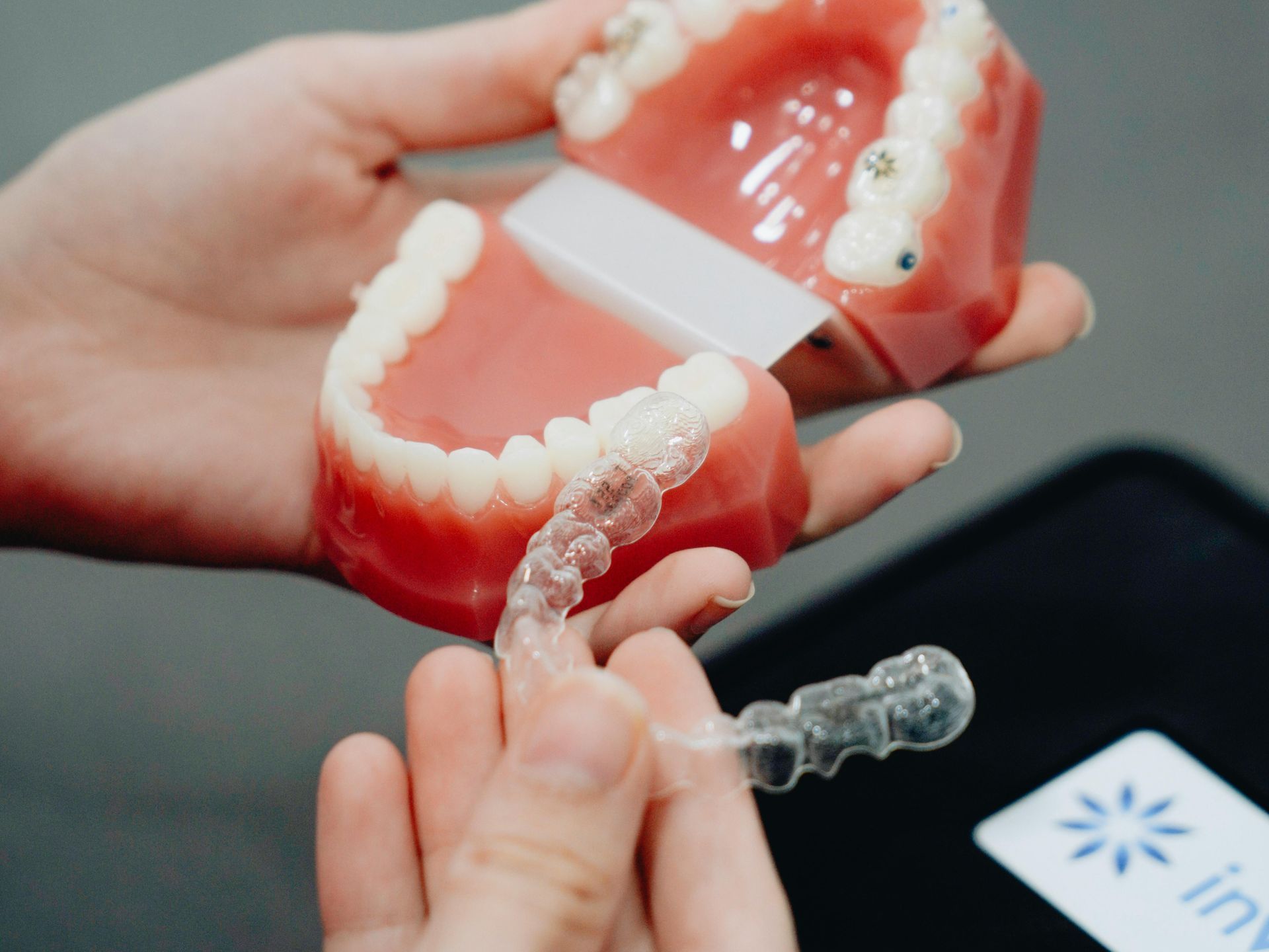 Clear Aligners Cost: What to Expect | Spring Hill Dental Center