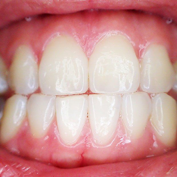 Tooth Anatomy 101 | Spring Hill Dental Center