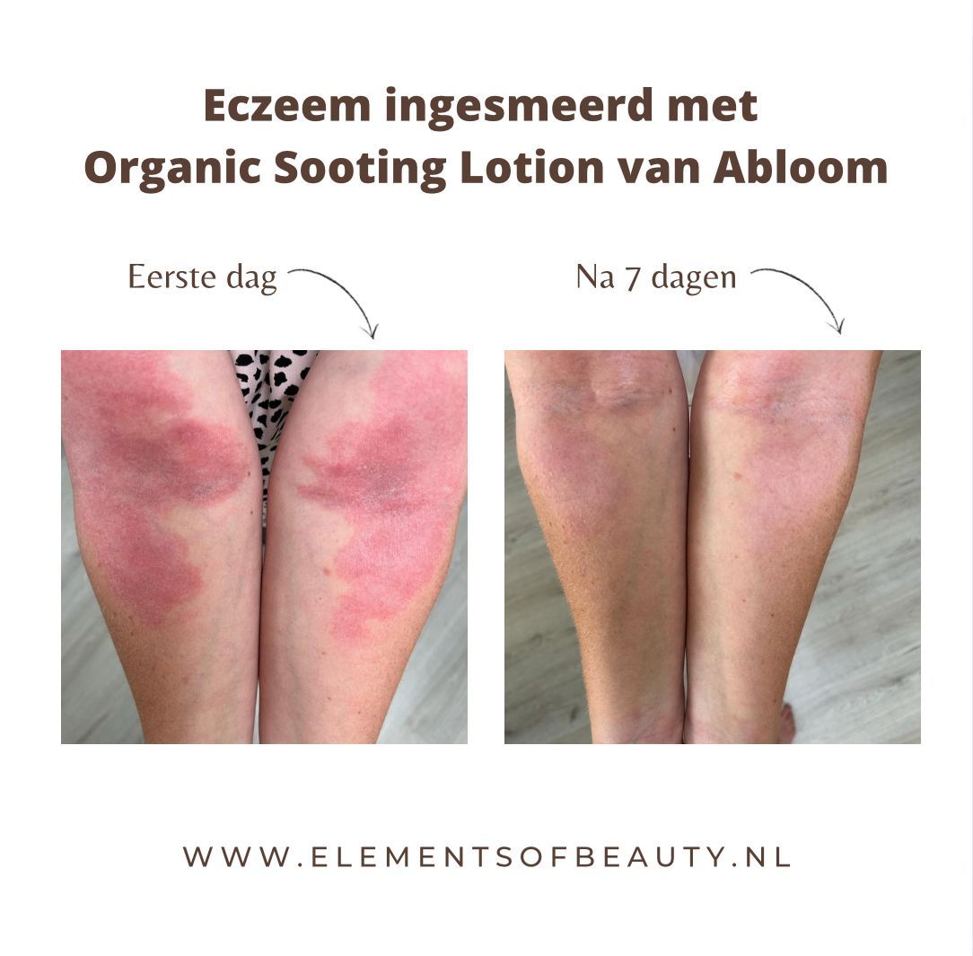 Abloom slow skincare natuurlijke huidverzorging en eczeem bij Elements of Beauty
