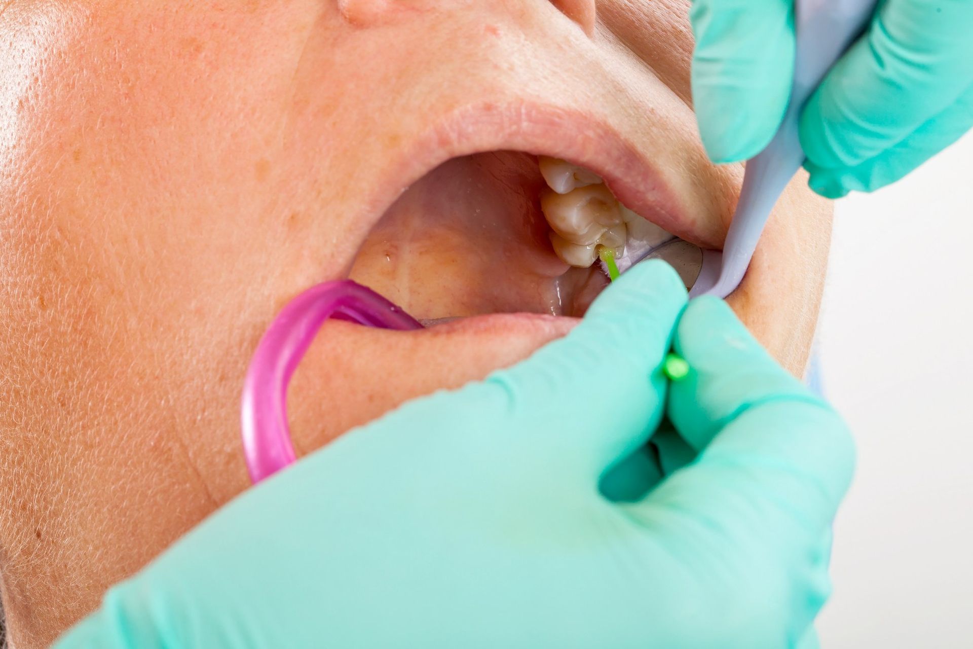 patient getting dental work done