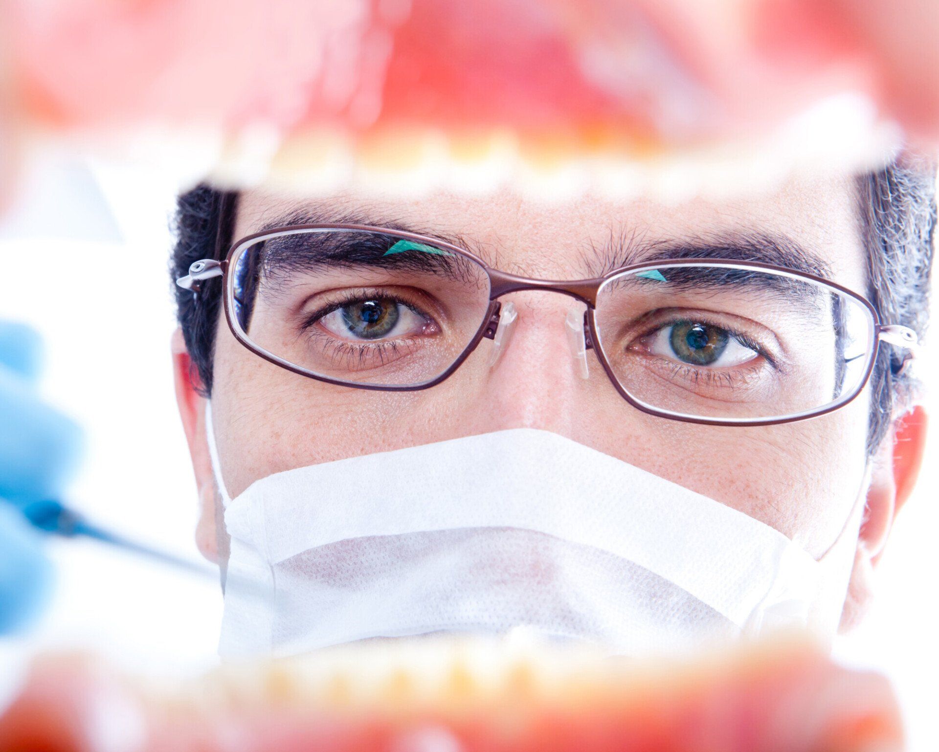 Root Canals
