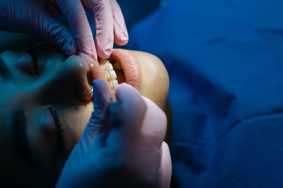 patient getting dental work