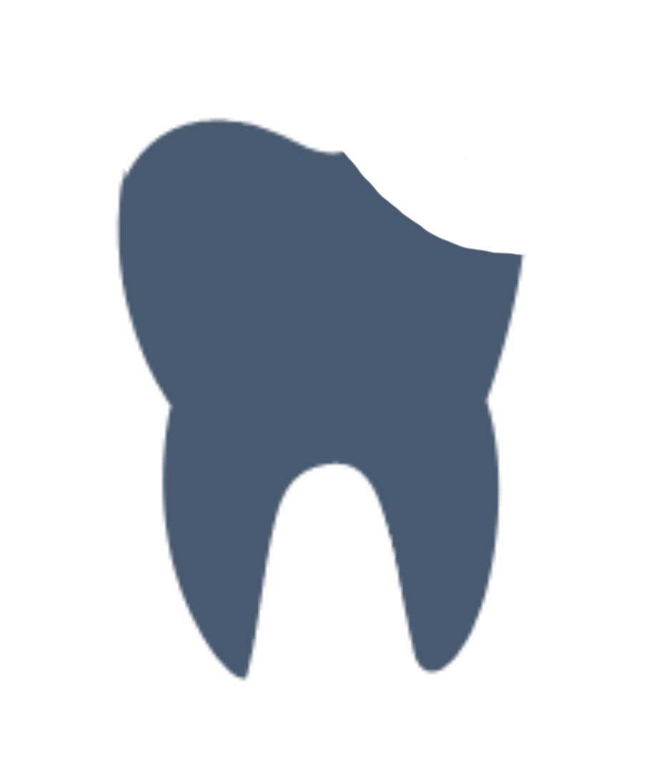 chipped tooth