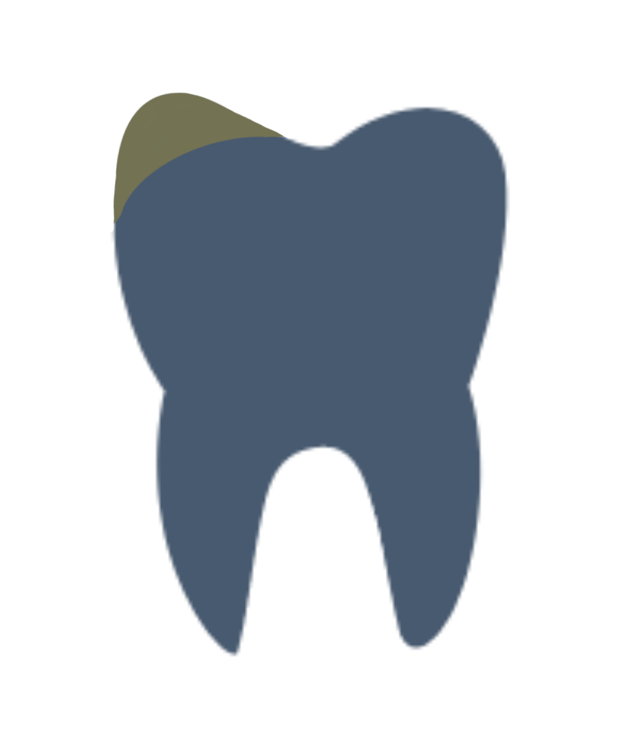 discolored tooth