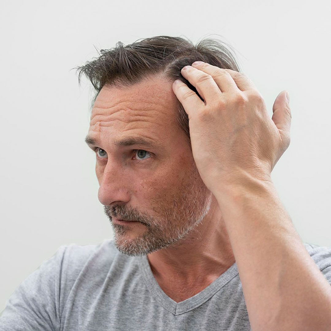 Man in a gray shirt looking at his hair while touching his head