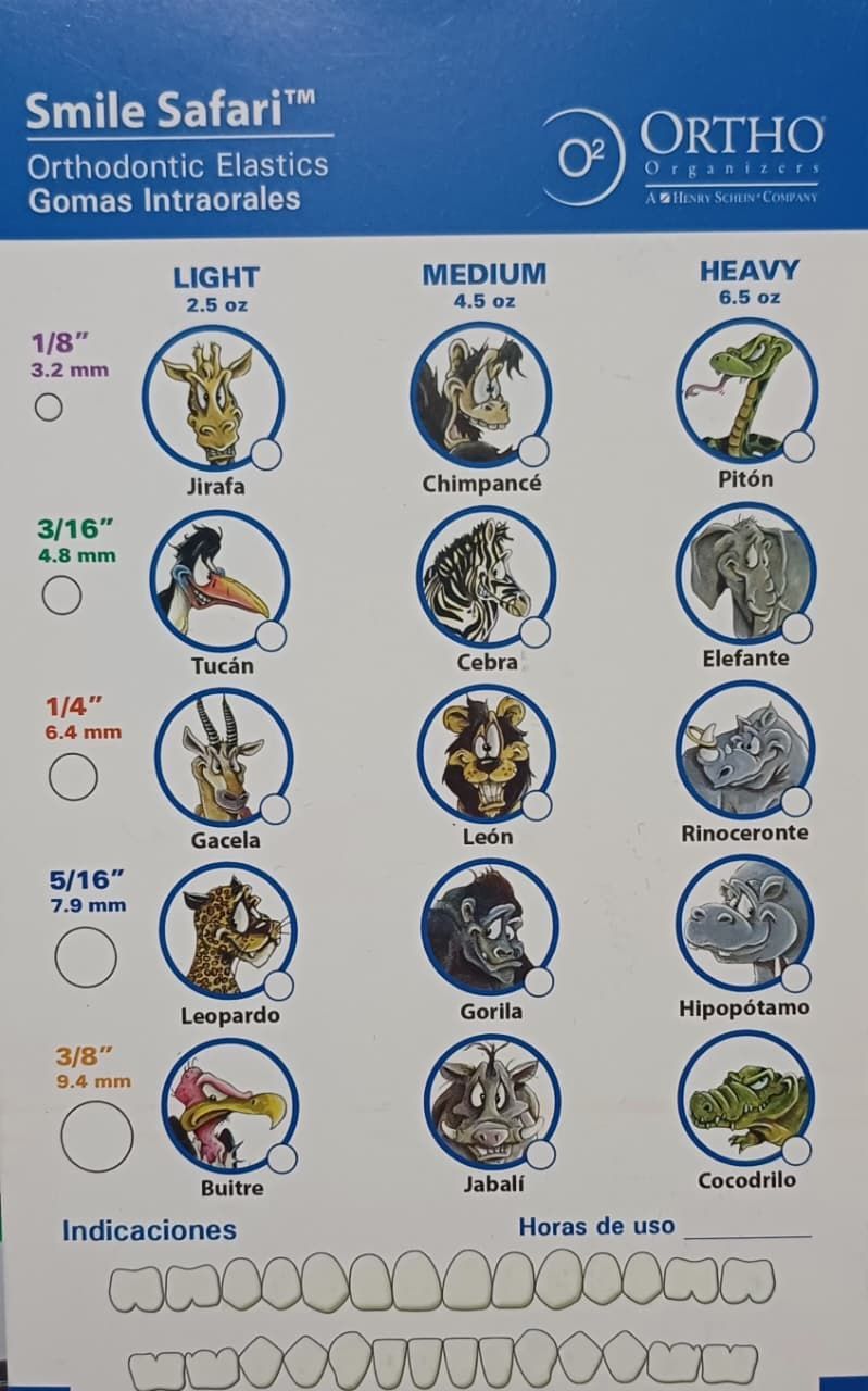 Tabla comparativa de brackets de ortodoncia con diferentes patrones de elásticos Smile Safari: ligeros, medios y fuertes.