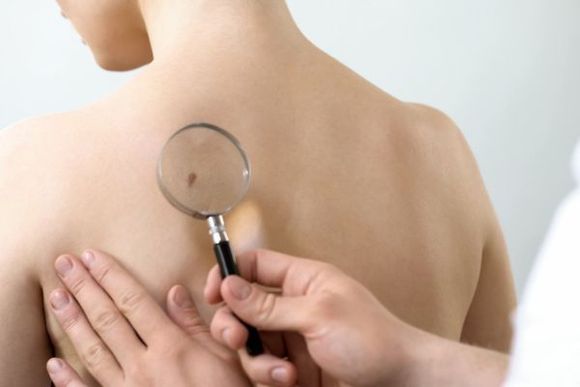 Skin Check and Minor Surgery