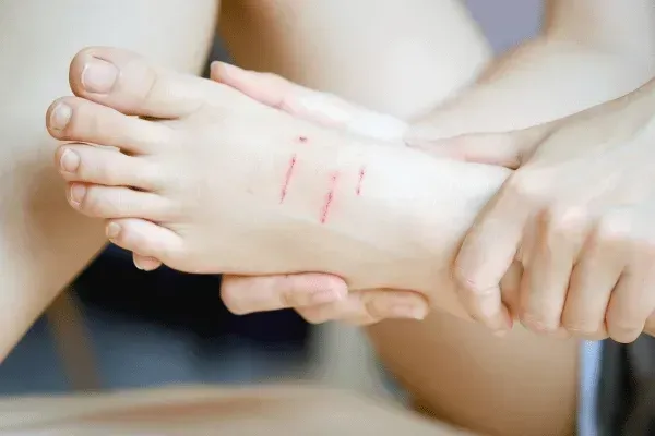 Tetanus