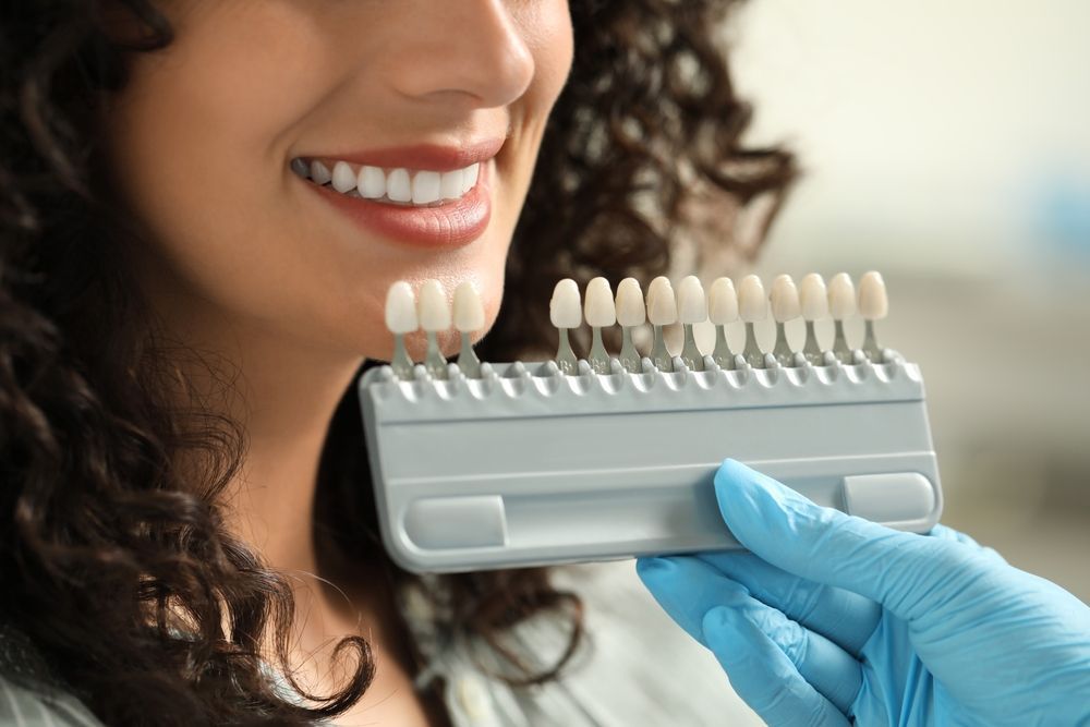 Woman Smiles While Dentist Holds Teeth Shade Guide — Trower Dental In Casuarina, NT