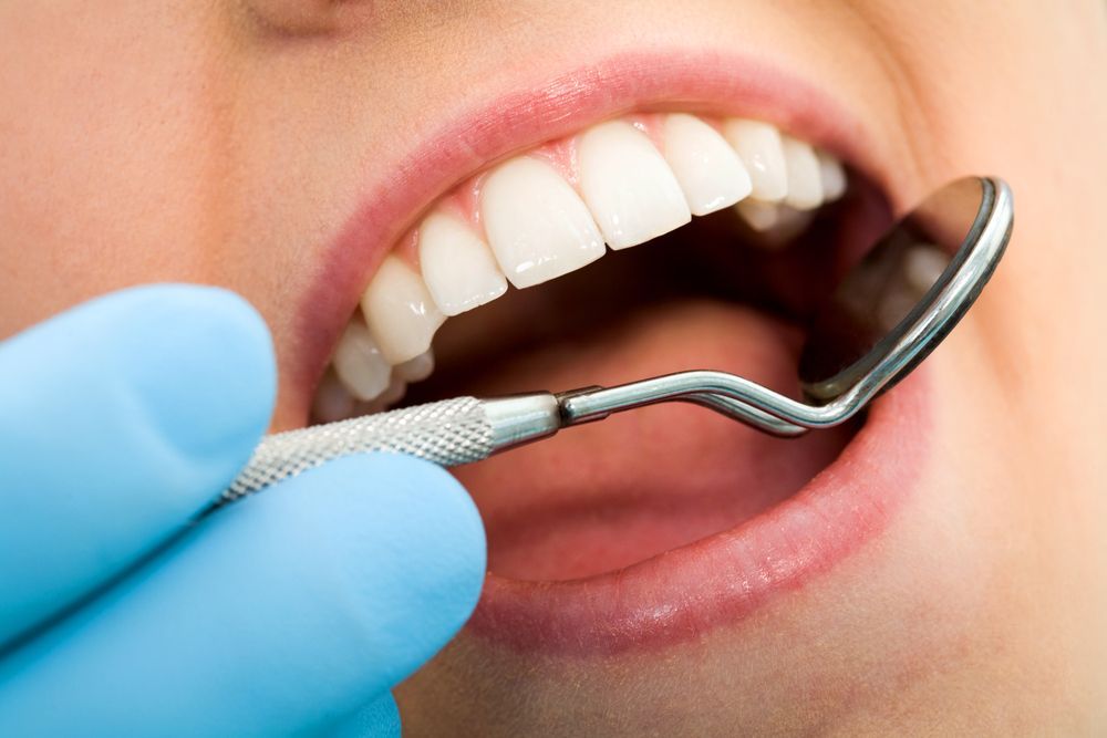Mouth open, dental mirror reflecting teeth during exam; blue-gloved hand. — Trower Dental In Casuarina, NT