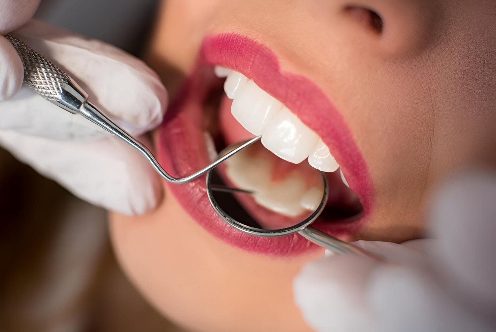 A Woman is Getting Her Teeth Examined by a Dentist — Trower Dental In Casuarina, NT