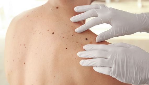 Visita dermatologica pediatrica