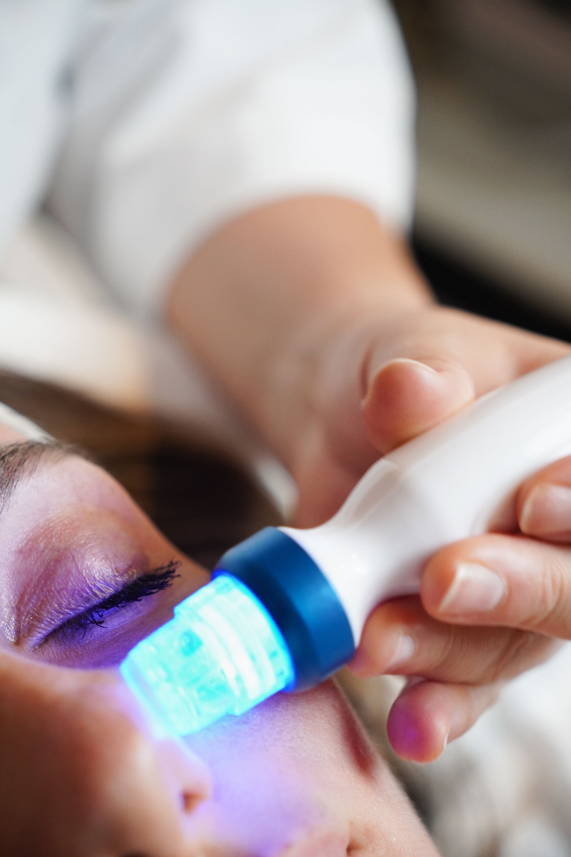 Een blauw LED-gezichtsapparaat wordt tijdens een huidverzorgingsbehandeling op de neus van een persoon geplaatst.