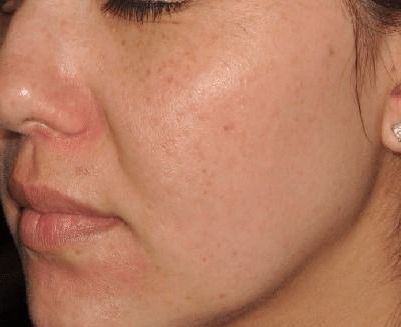 A close up of a woman 's face with freckles and earrings.