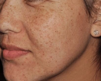 A close up of a woman 's face with freckles and earrings.